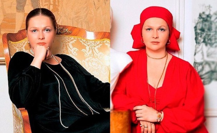 Гундарева до и после пластики