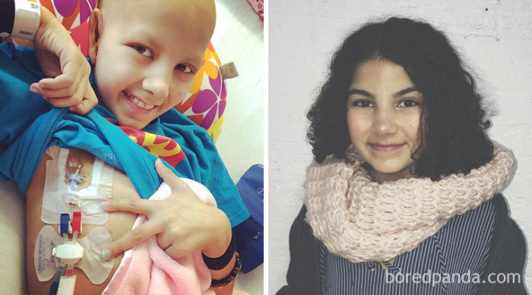 Победили рак сами. Люди с онкологией до и после. Дети до онкологии и после. Больные дети до и после.