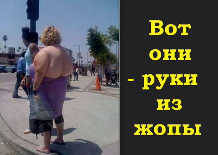 Как выглядит рука жоп