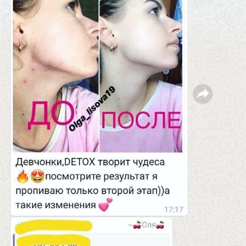 Детокс Фото До И После